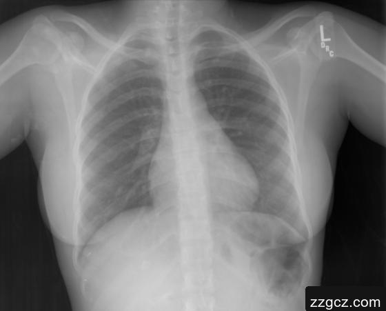 Image Token: XTtJbZQ6noAITVxqoBpcTrHUnsd