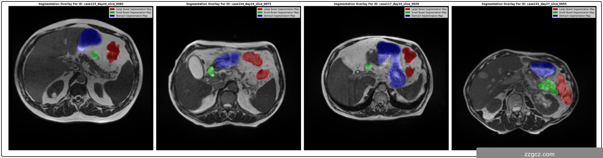 Image Token: VKI1bwjpMokZlnxgyt3czGy7nhg