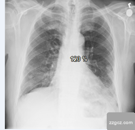 Image Token: QSdTbEpESo7TlTxKWIQc92SRnAh