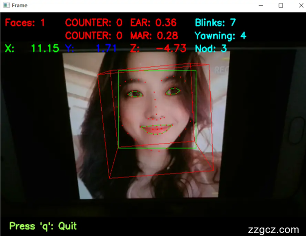 Image Token: Hm9qb4Mwooxzhax4qMbcqv5Ynhe